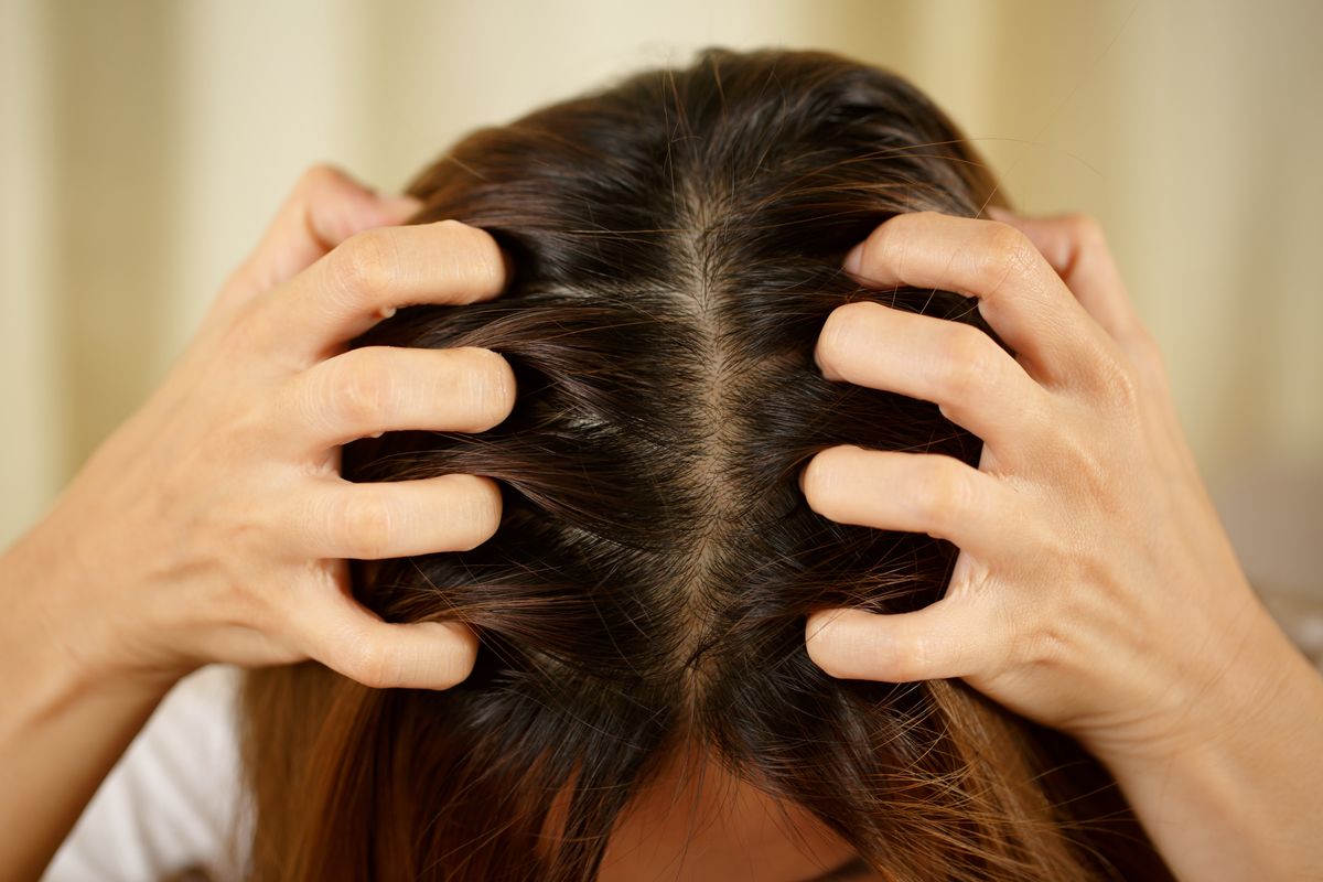 Home Remedies for Scalp Fungus