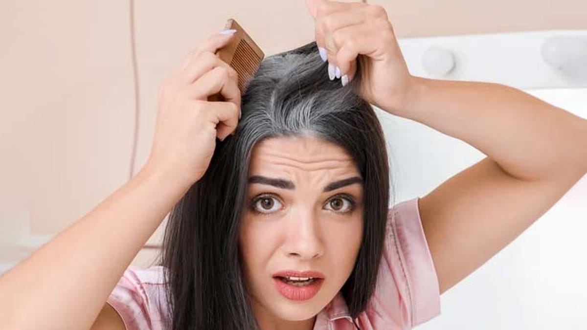 White Hair in Early Age: Causes, Prevention and Natural Remedies!
