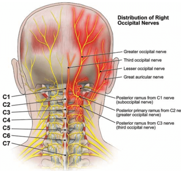 Occipital Neuralgia: Understanding Symptoms, Causes, and Effective Management
